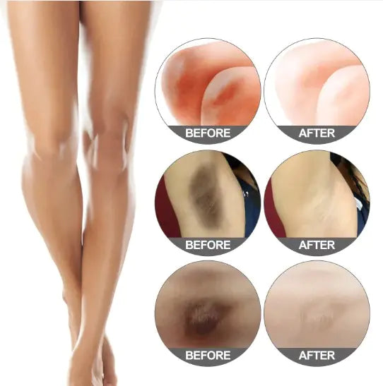 Exfoliating Whitening Cream
